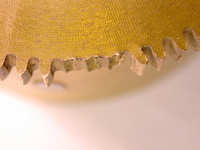 Broken teeth